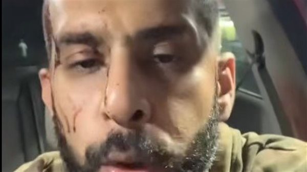 الأمن يحقق في واقعة اعتداء على سائق أوبر بالصحراوي في الجيزة خلال محاولة سرقته