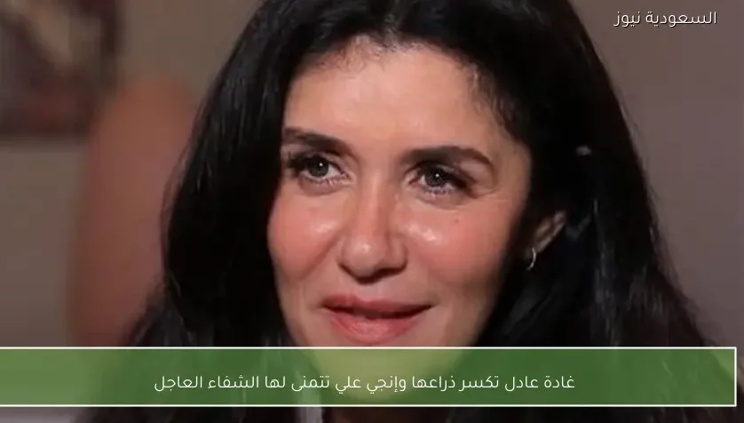 غادة عادل تكسر ذراعها وإنجي علي تتمنى لها الشفاء العاجل